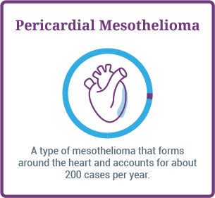 Pericardial mesothelioma