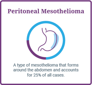 Peritoneal mesothelioma statistics