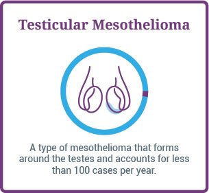 Testicular mesothelioma