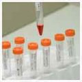 Blood samples